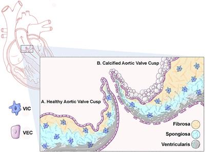 The Genetic Regulation of Aortic Valve Development and Calcific Disease